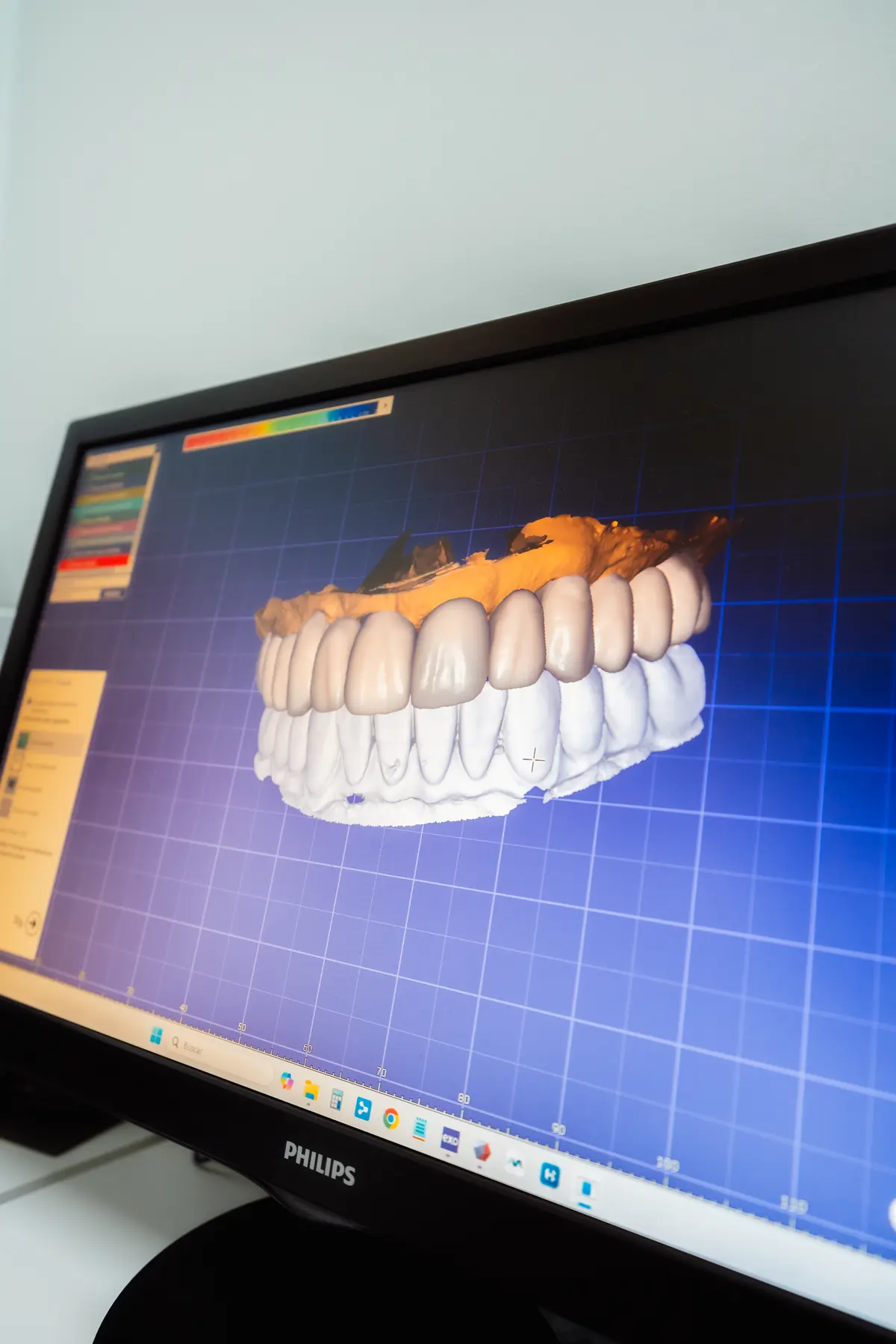 Inversión en marketing dental